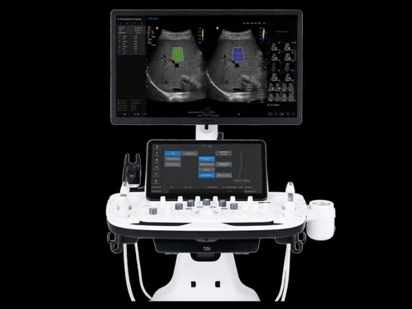 초음파 (Samsung V7)