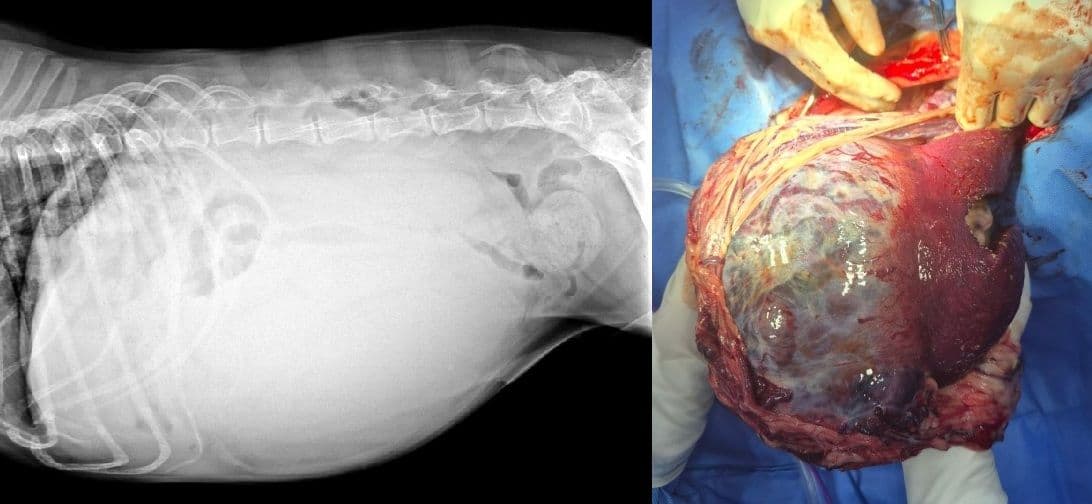 비장 종양 (Spleen Tumor)